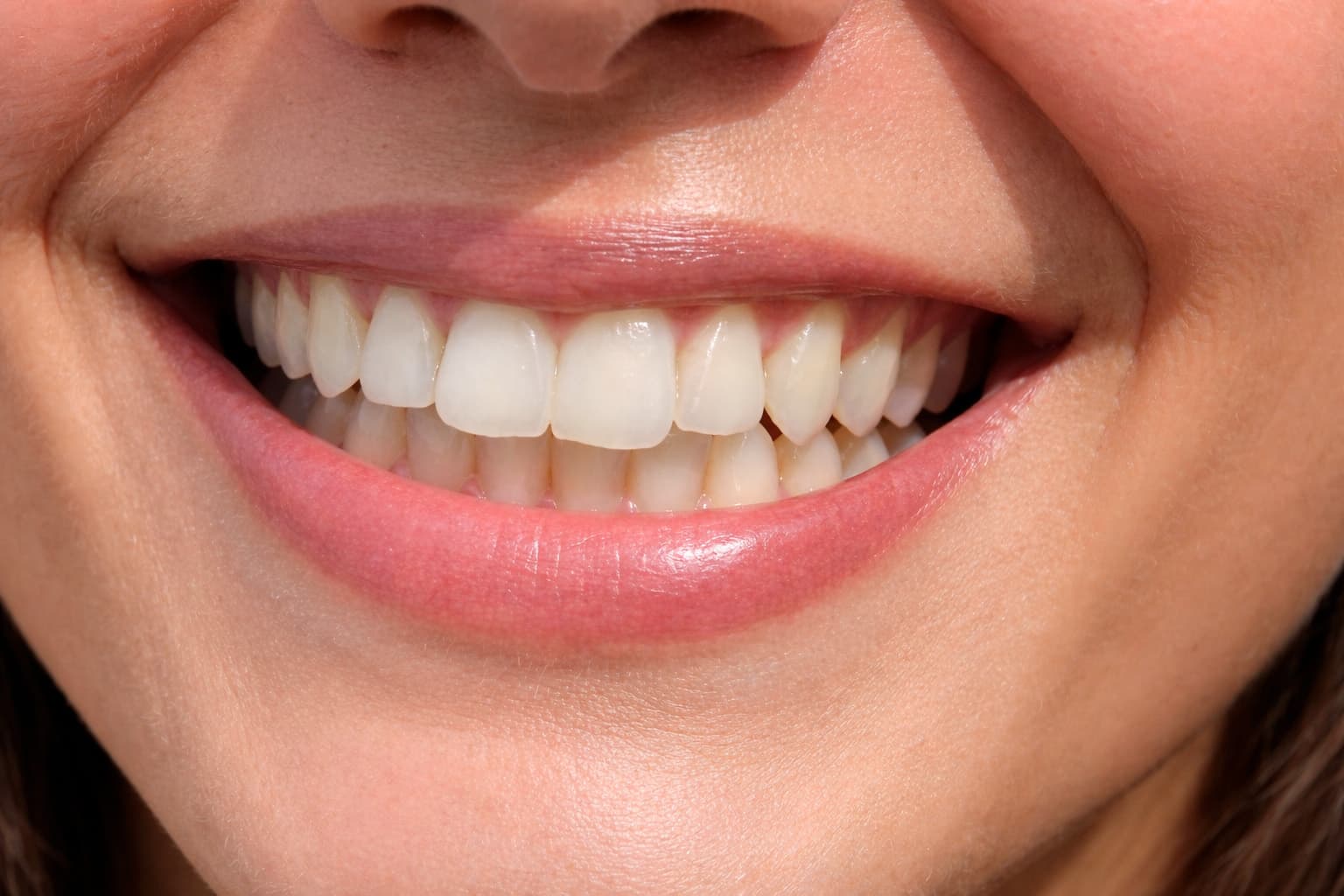 Sonríe sin preocuparte